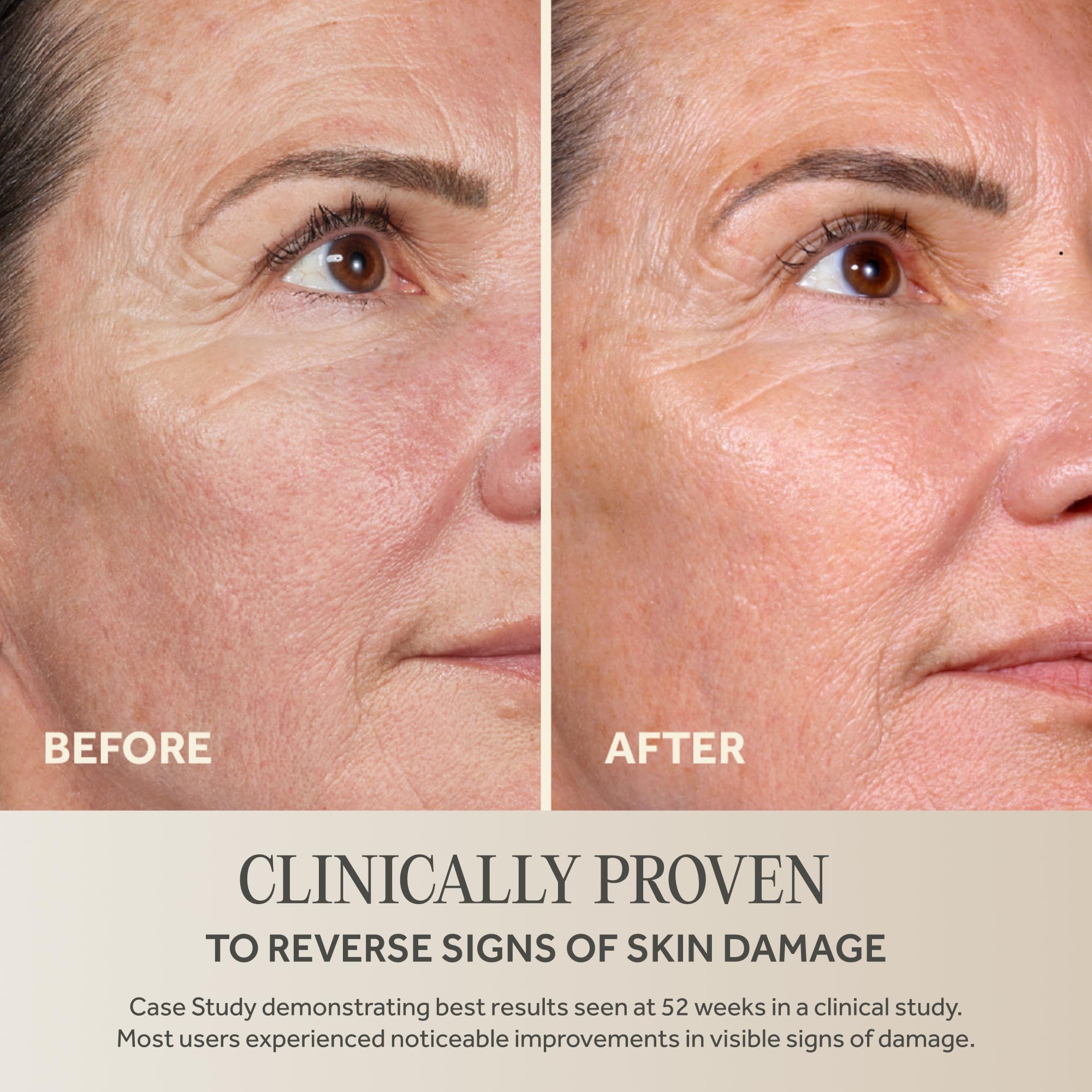Amazon.com: No7 Future Renew Damage Reversal Face Serum - Fast
